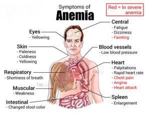 anemia-ayurvedic home remedies