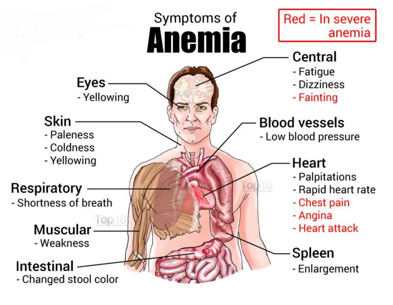 Anaemia Ayurvedic Home Remedies