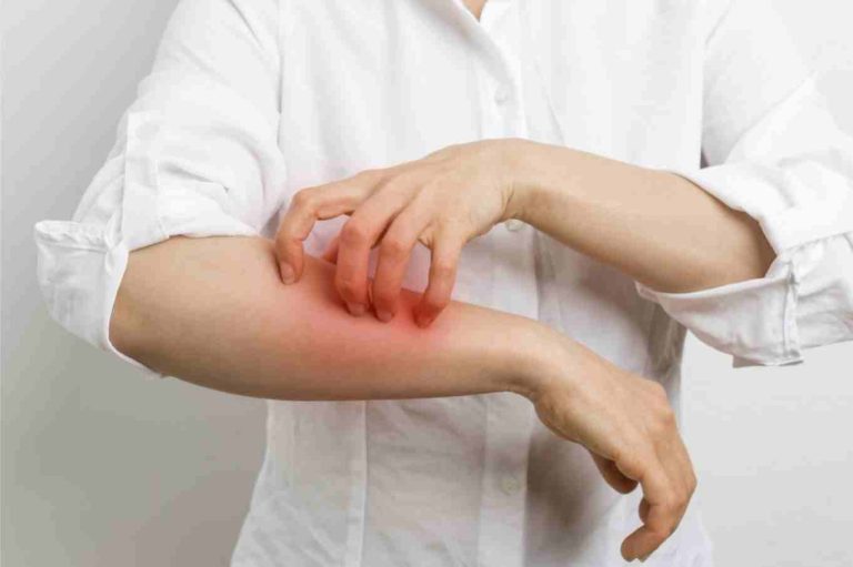 Ayurvedic Treatment For Scabies